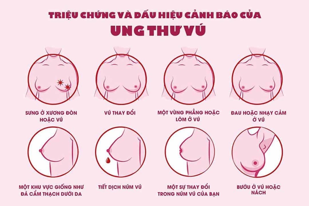 Căn bệnh ung thư phụ nữ Việt mắc nhiều nhất - 1