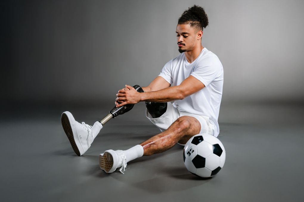 Cầu thủ bóng đá phải cắt bỏ chân vì mắc bệnh do não mô cầu - 2