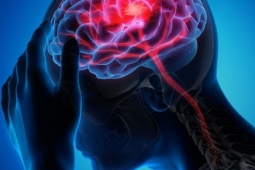 Hơn 99% các cơn đột quỵ và nhồi máu cơ tim liên quan 4 điều này