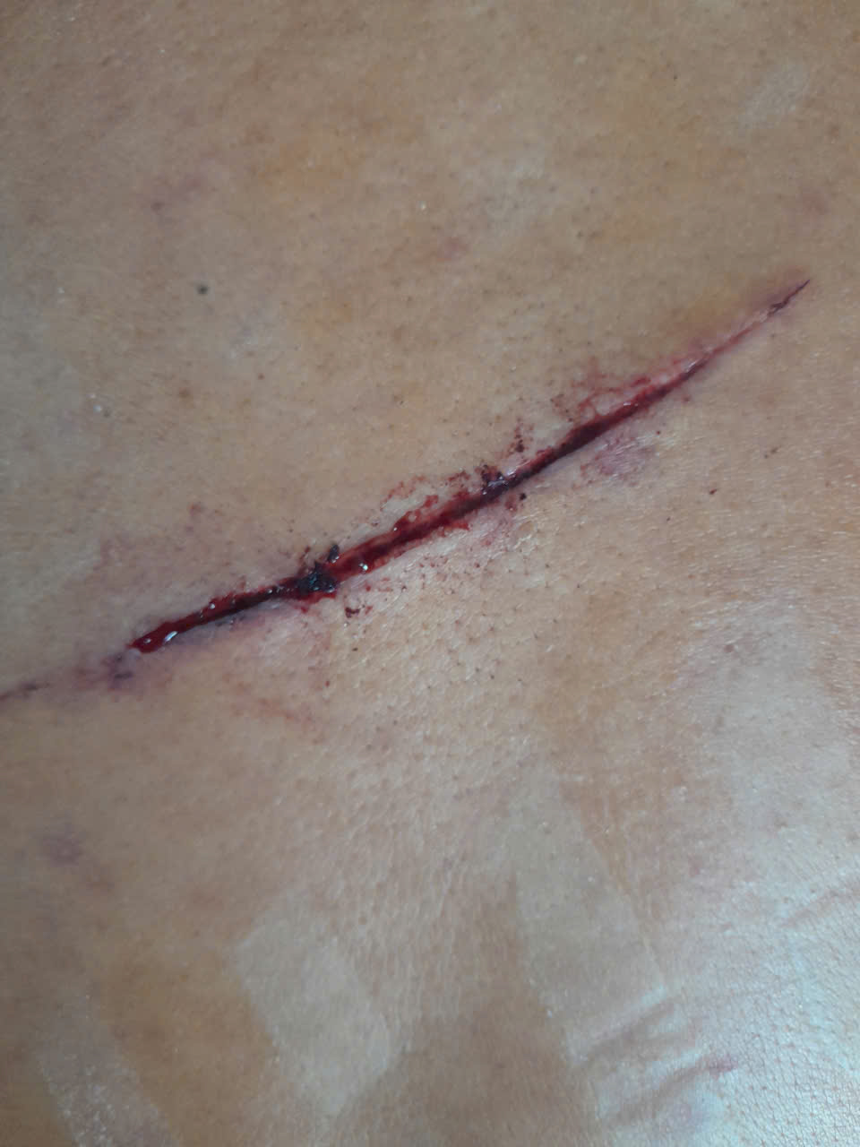 Dân 'tố' bị giang hồ hành hung, bao chiếm mặt biển, công an vào cuộc điều tra 2 Dân 'tố' bị giang hồ hành hung, bao chiếm mặt biển, công an vào cuộc điều tra - Ảnh 3.