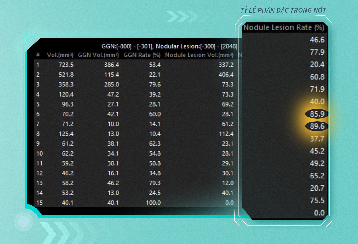 AI chấm điểm nghi ngờ ác tính từng nốt tổn thương