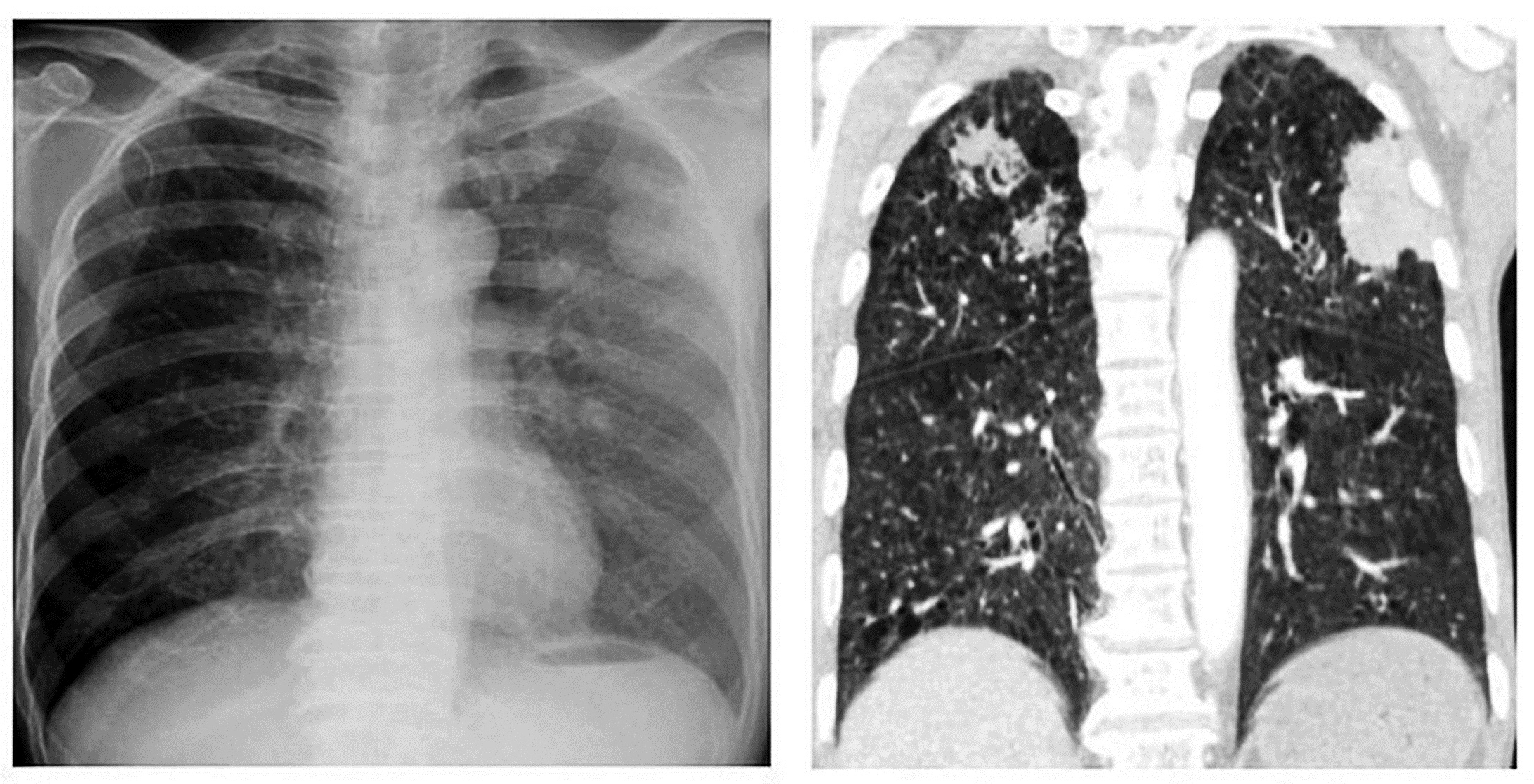 Giun lươn nguy hiểm nhưng bị lãng quên - Ảnh 2.