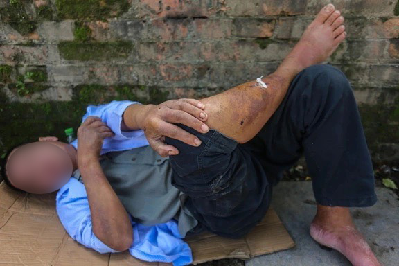 Người đàn ông ở Huế bị nhóm học sinh đánh đập: Hoàn cảnh đáng thương, vẫn còn sợ hãi- Ảnh 1.