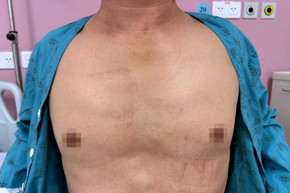 Khách đang ăn sáng ngã quỵ, chủ quán ép tim gần 1 tiếng tạo kỳ tích - 1