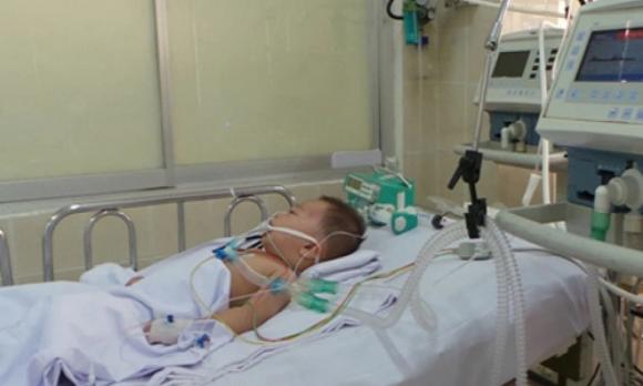 đột quỵ ở người trẻ, trẻ em bị đột quỵ