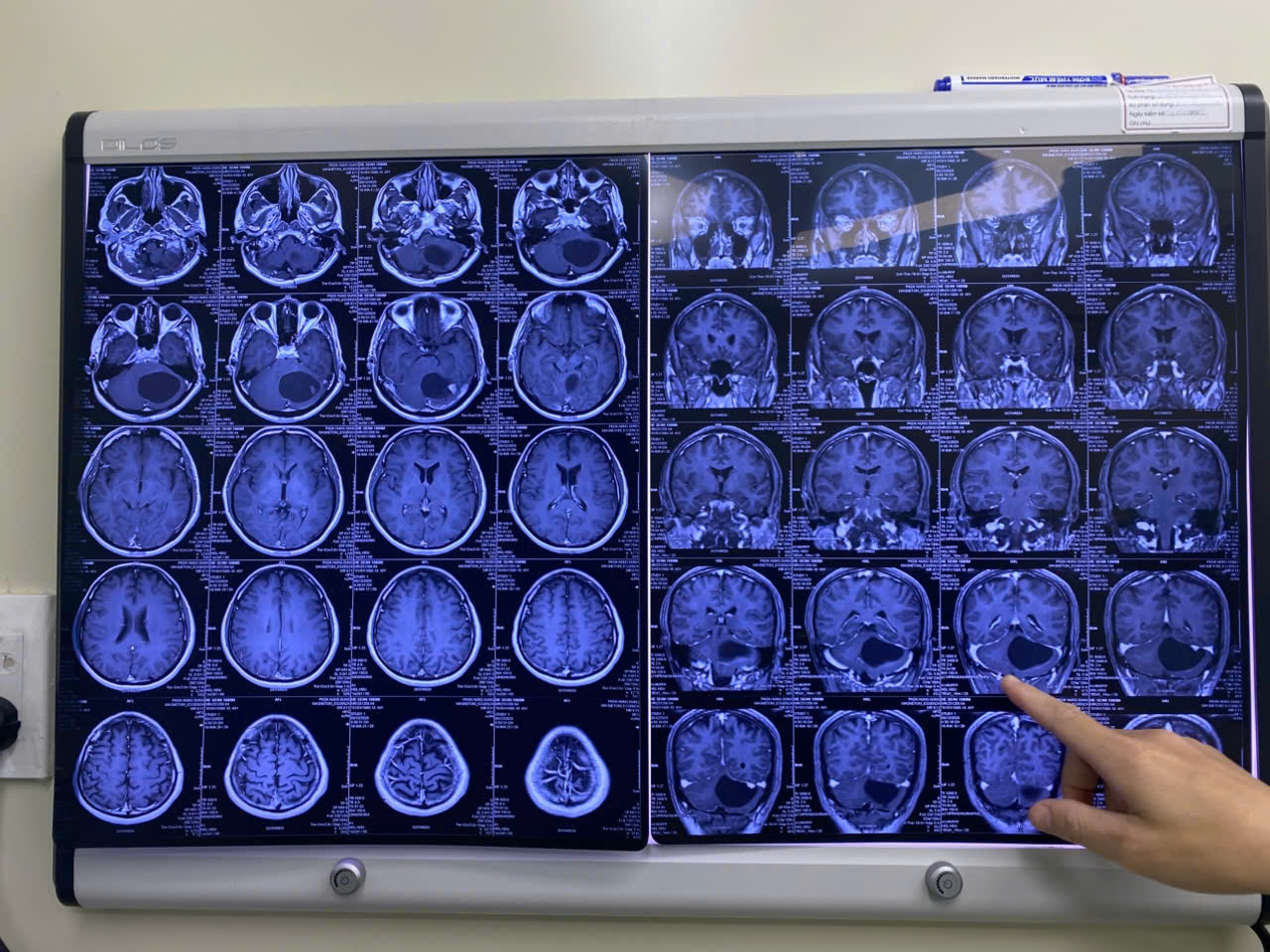 - Ảnh 1. - Ảnh 1.