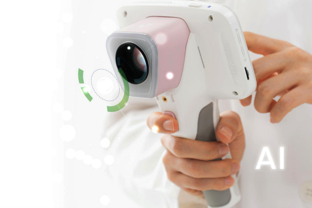 Loại ung thư làm 2.500 phụ nữ Việt tử vong/năm: AI tầm soát được không? - 2