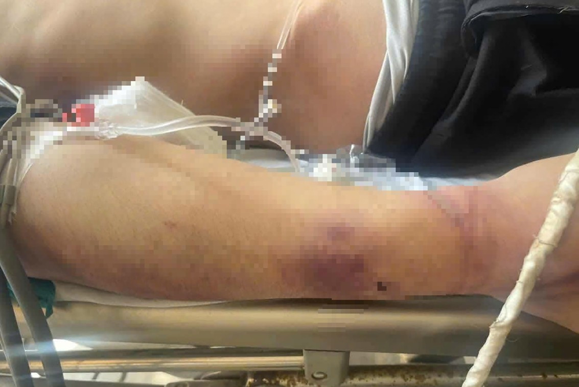 Lời kể nhân chứng vụ học viên tử vong sau 2 ngày nhập học- Ảnh 1.