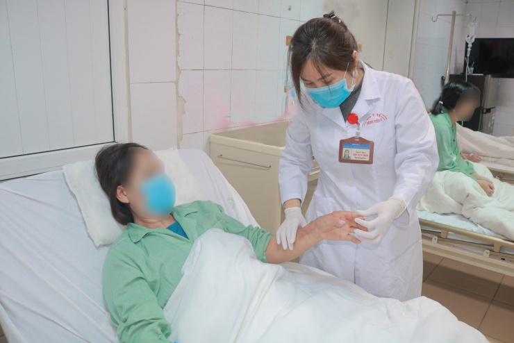 Bệnh nhân bị bỏng nặng được cấp cứu tại bệnh viện E. Ảnh BVCC