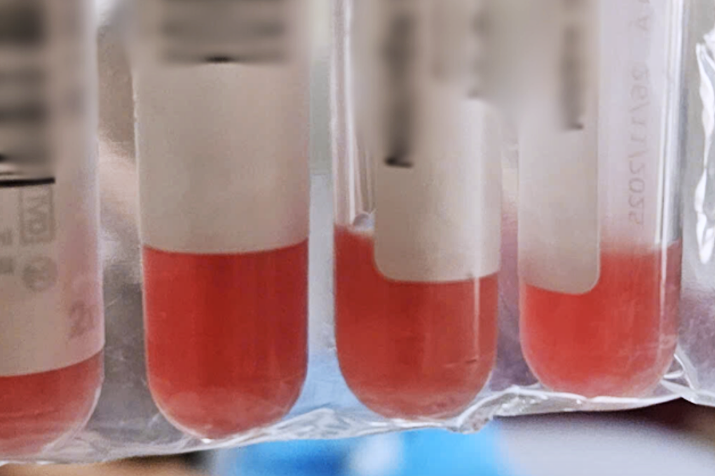 Người phụ nữ ở TPHCM bỗng cứng cổ, liên tục nôn ói nguy kịch khi đi vệ sinh - 1