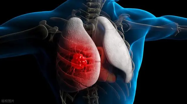 Người sống thọ, phổi khỏe thường hội tụ 5 đặc điểm này 1 Người sống thọ, phổi khỏe thường hội tụ 5 đặc điểm này - 1