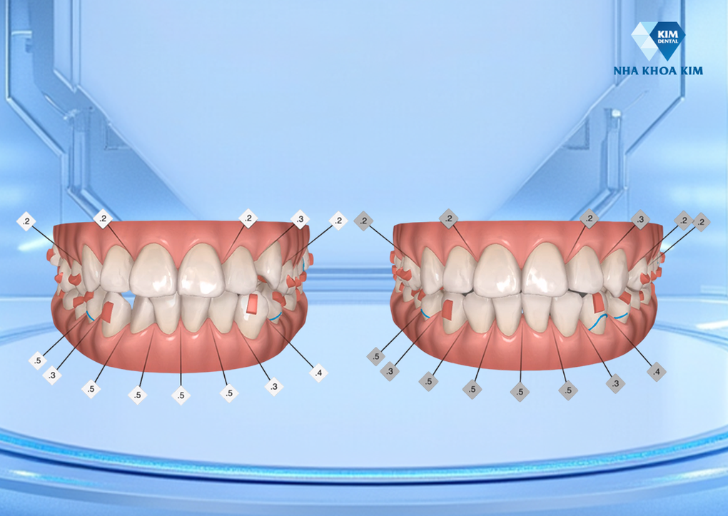 Nha Khoa Kim và hành trình kiến tạo giá trị nụ cười cho cộng đồng - 2