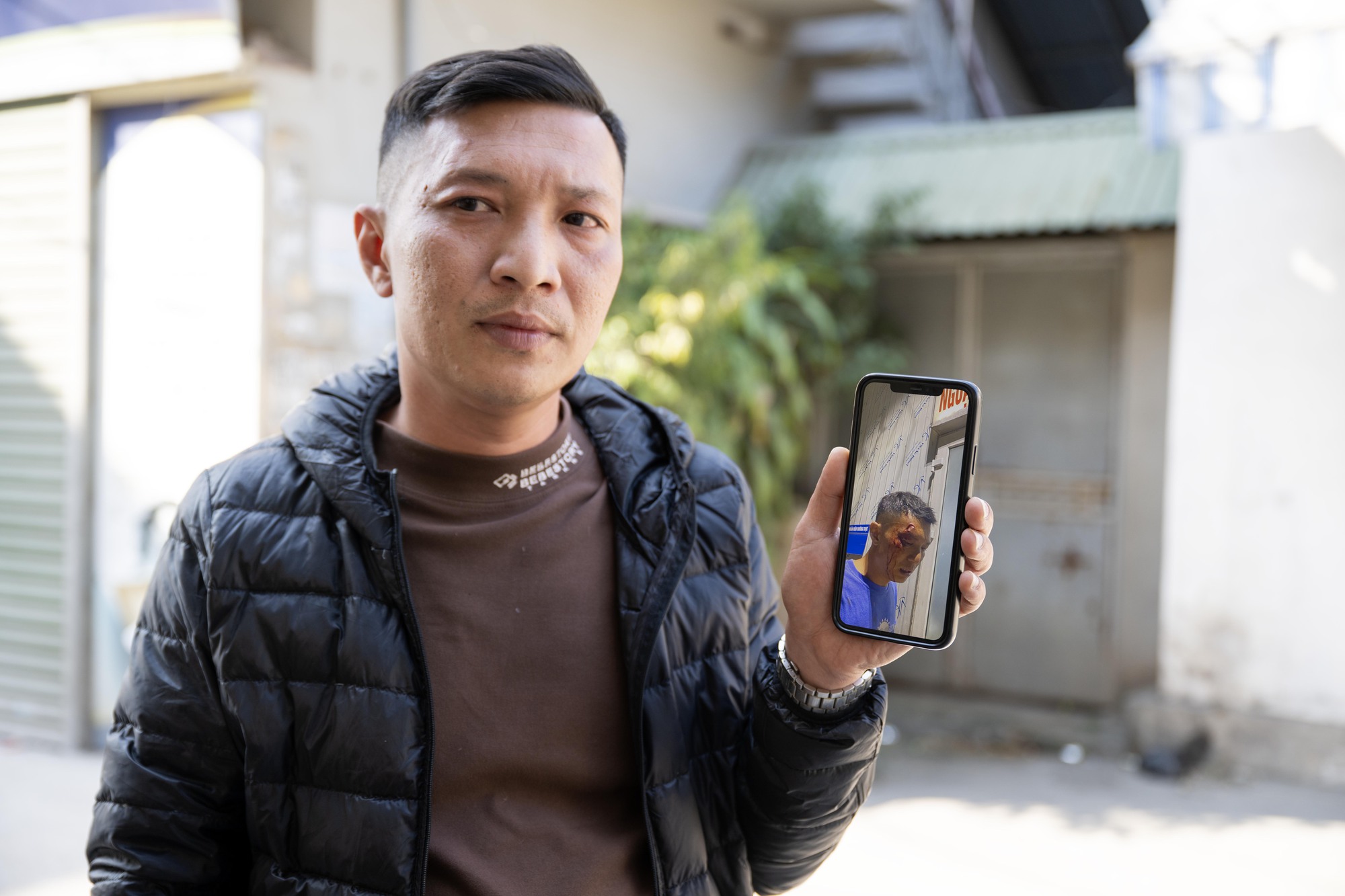 Vụ thả chó dữ cắn người phụ nữ ở Hà Nội: Nhân chứng kể lại phút kinh hoàng và quá khứ 