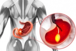 Ung thư tuyến tụy là sát thủ thầm lặng, làm thế nào để tránh?