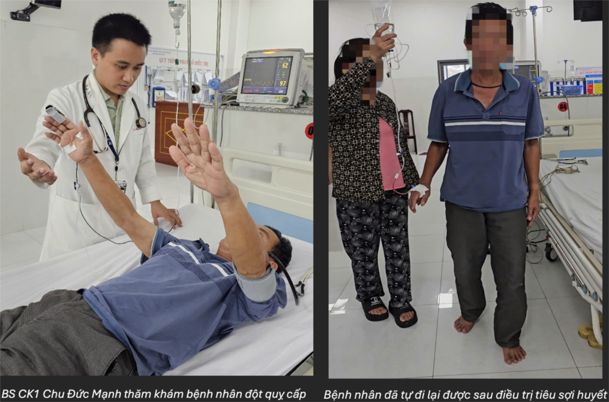 Nhiều ca đột quỵ nặng được cứu sống ngay tại đặc khu Côn Đảo 1 đột quỵ - Ảnh 1.