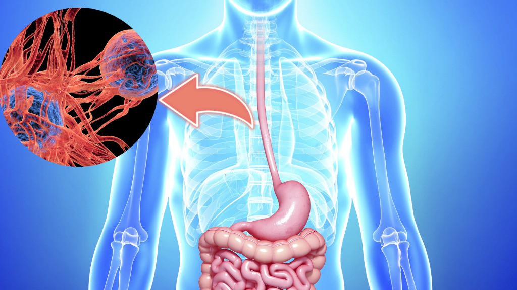 Những món người Việt yêu thích không ngờ làm tăng nguy cơ mắc ung thư thực quản 1 Những món người Việt yêu thích không ngờ làm tăng nguy cơ mắc ung thư thực quản - 1