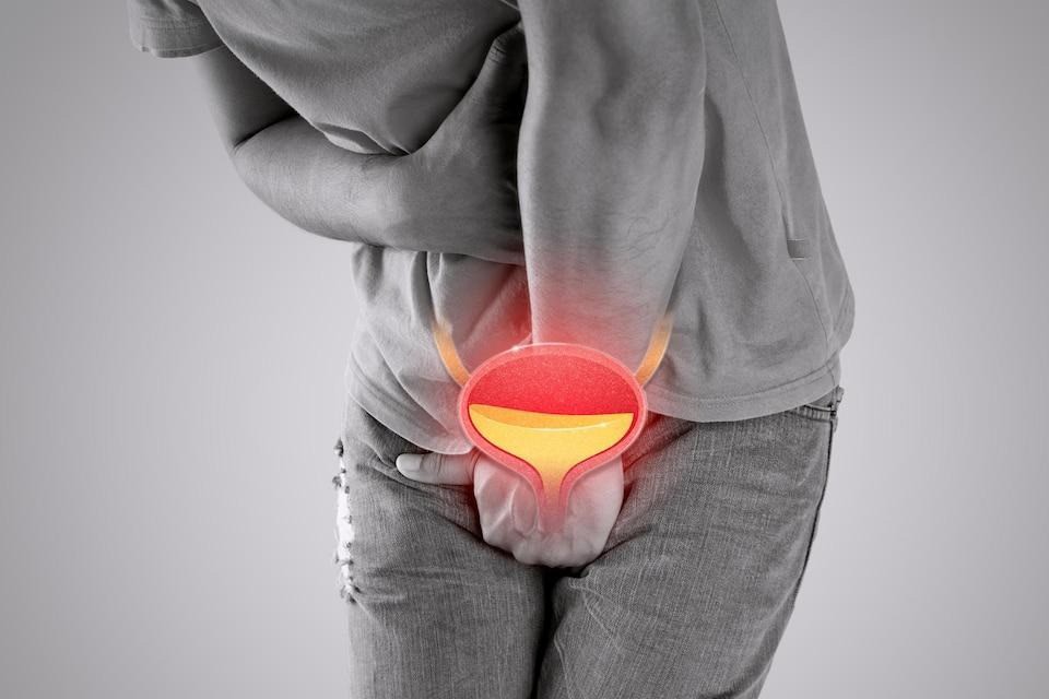 Những thói quen gây hại cho tuyến tiền liệt quý ông cần tránh 1 Những thói quen gây hại cho tuyến tiền liệt quý ông cần tránh - 1