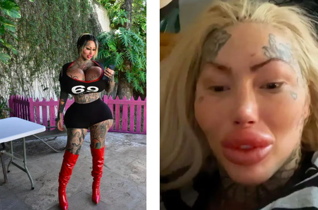 Nữ người mẫu nghiện phẫu thuật thẩm mỹ tử vong sau cú ngã từ tầng 9 - 1