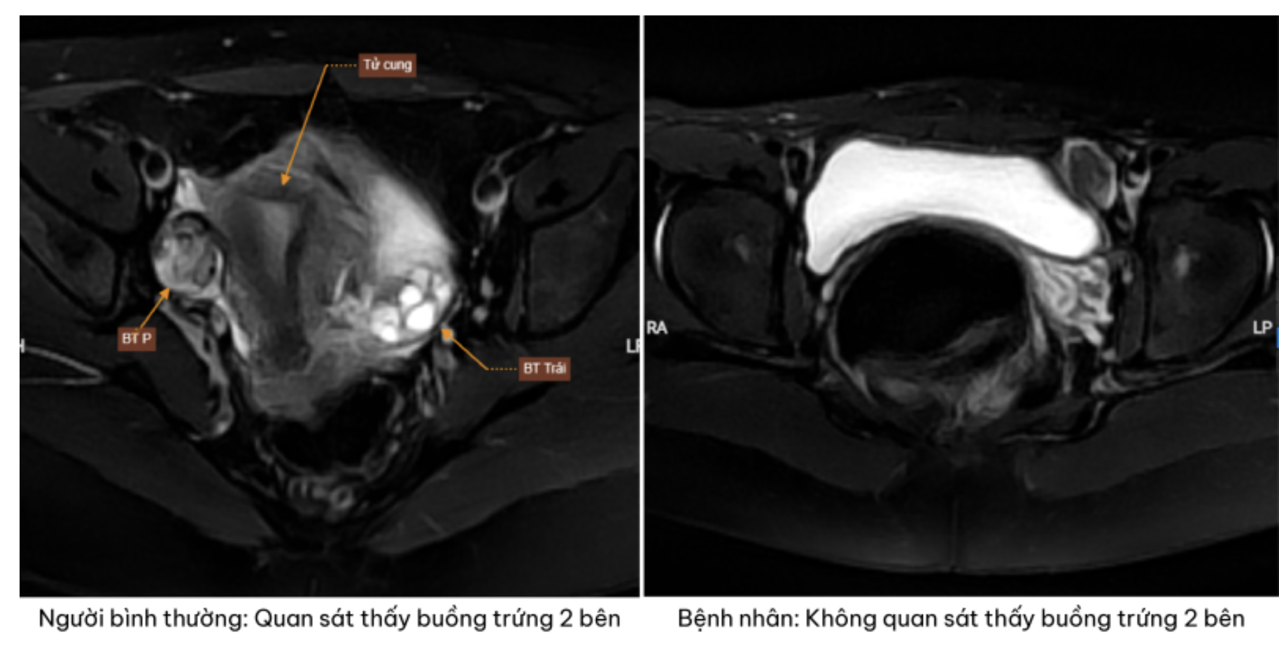 giới tính - Ảnh 1.