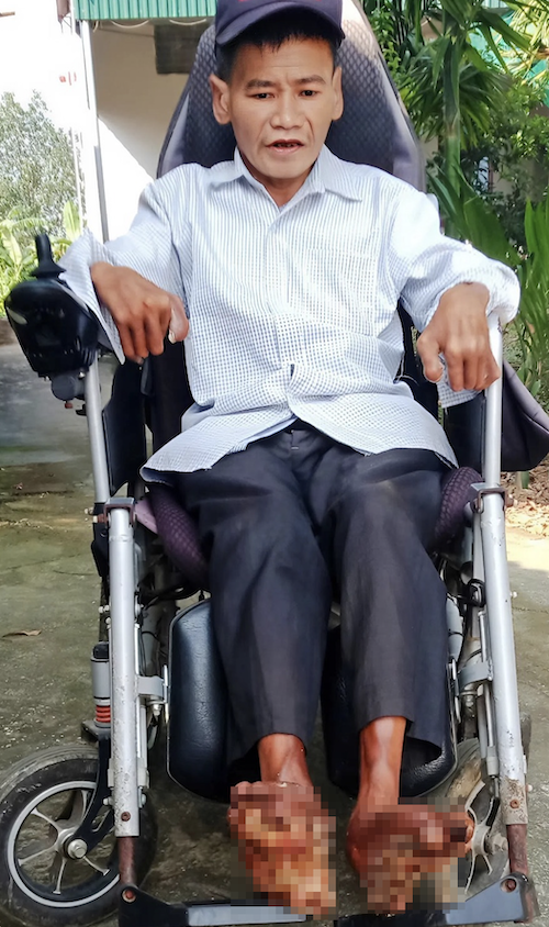 Anh Sơn trên xe lăn tại nhà. Ảnh: Sơn Nguyễn