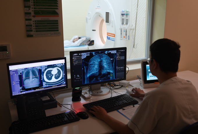 Tầm soát ung thư phổi bằng máy chụp cắt lớp vi tính. Ảnh: Bệnh viện Đa khoa Tâm Anh