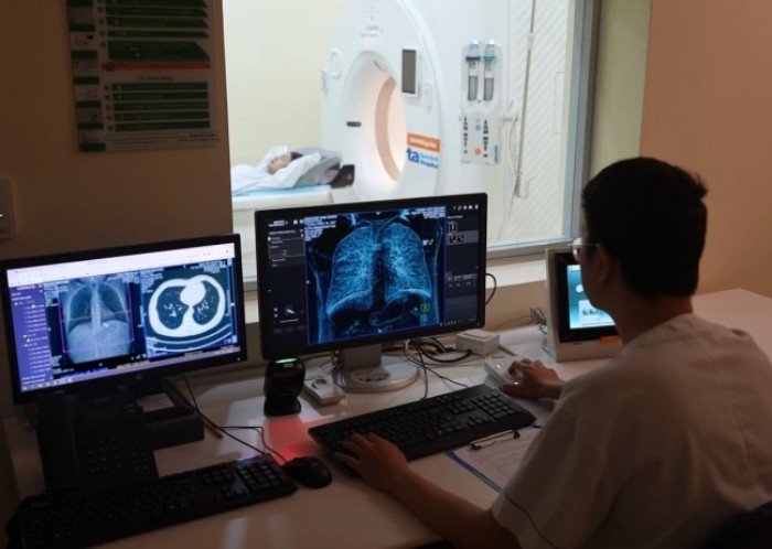 Ô nhiễm không khí có gây ung thư? 1 Tầm soát ung thư phổi bằng máy chụp cắt lớp vi tính. (Ảnh: BVCC)