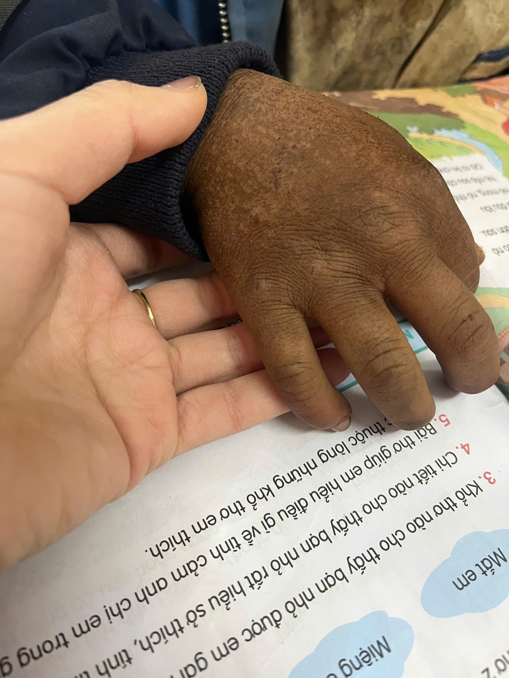 Phía sau bức ảnh bàn tay bé 8 tuổi ở vùng cao khiến triệu người lay động - 1