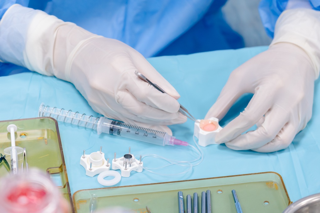 Sáng chế của nữ bác sĩ Việt tạo bước tiến mới trong ghép giác mạc - 1