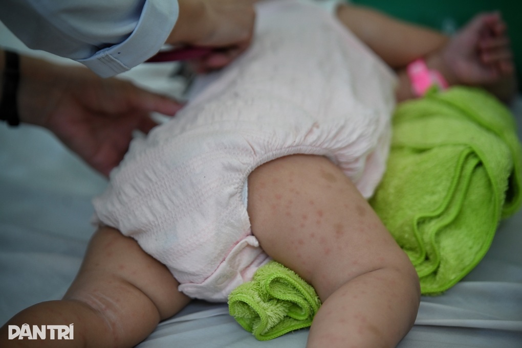 Sở Y tế TPHCM cảnh báo tác nhân gây bệnh truyền nhiễm quay trở lại - 1