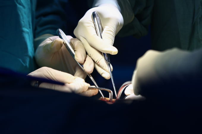 Bác sĩ phẫu thuật cho bệnh nhân. Ảnh: Quỳnh Trần