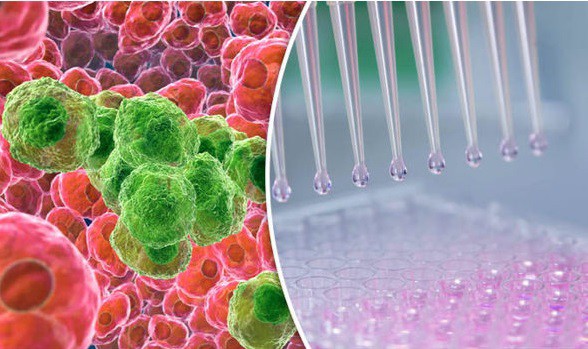 Tế bào ung thư sợ gì nhất?: Phát hiện nhiều điểm yếu để loại bỏ tế bào ung thư 1 Ảnh minh họa.
