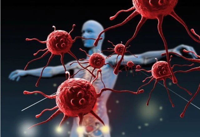 Tế bào ung thư sợ nhất 4 việc này, người Việt cần làm tốt điều này để kìm hãm tế bào ung thư 1 Ảnh minh họa.