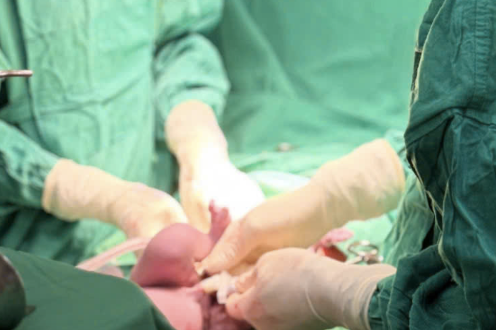 Thai phụ 19 tuổi cùng con sắp chào đời bỗng nguy kịch sau một cơn đau đầu - 1