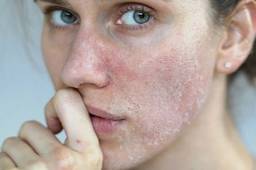 Thận yếu da có thể xuất hiện 6 triệu chứng lạ mà quen này - 1