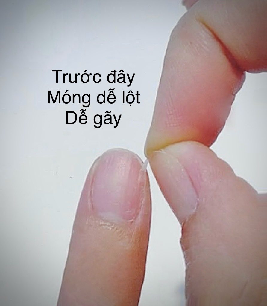 Thuỷ Tiên ăn chay trường, bất ngờ nhận điều thay đổi sau 1 năm- Ảnh 1.