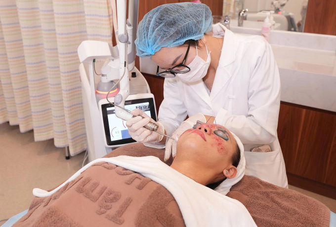 Bác sĩ đang trị nám cho một phụ nữ. Ảnh: Bệnh viện Đa khoa Tâm Anh