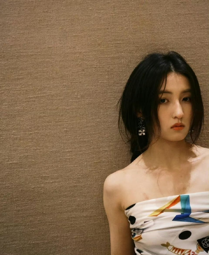 Sao nữ gen Z lộ vết bầm bất thường trên ngực và cánh tay- Ảnh 1.