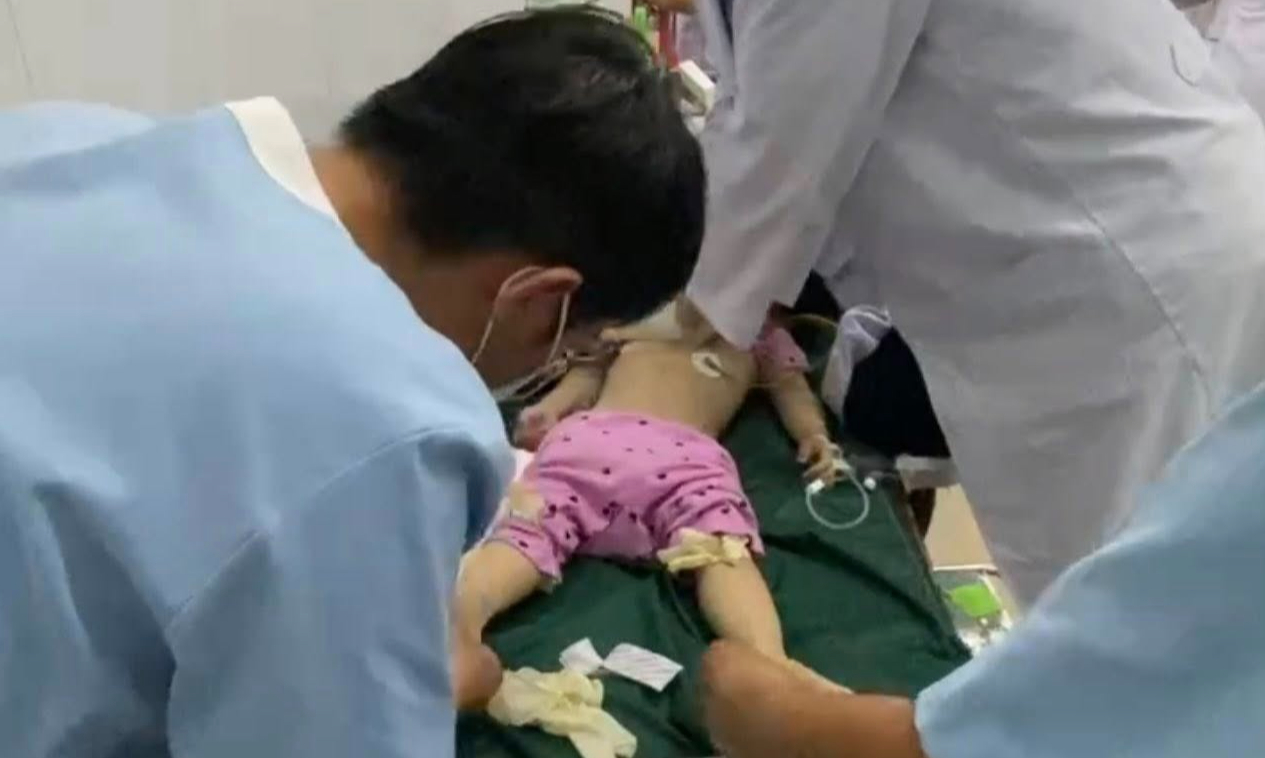 Từ vụ bé 3 tuổi tử vong vì sặc thức ăn ở nhà trẻ, bác sĩ nêu cách xử trí đúng ngay tại chỗ 1 sặc thức ăn - Ảnh 1.