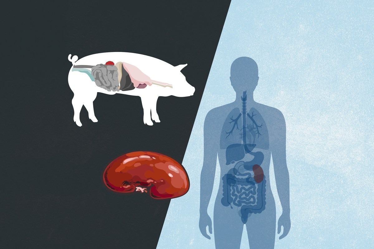 Vì sao Mỹ ghép tạng heo cho người nhưng cấm tạo tạng người trong heo? 1 Vì sao Mỹ ghép tạng heo cho người nhưng cấm tạo tạng người trong heo? - Ảnh 1.