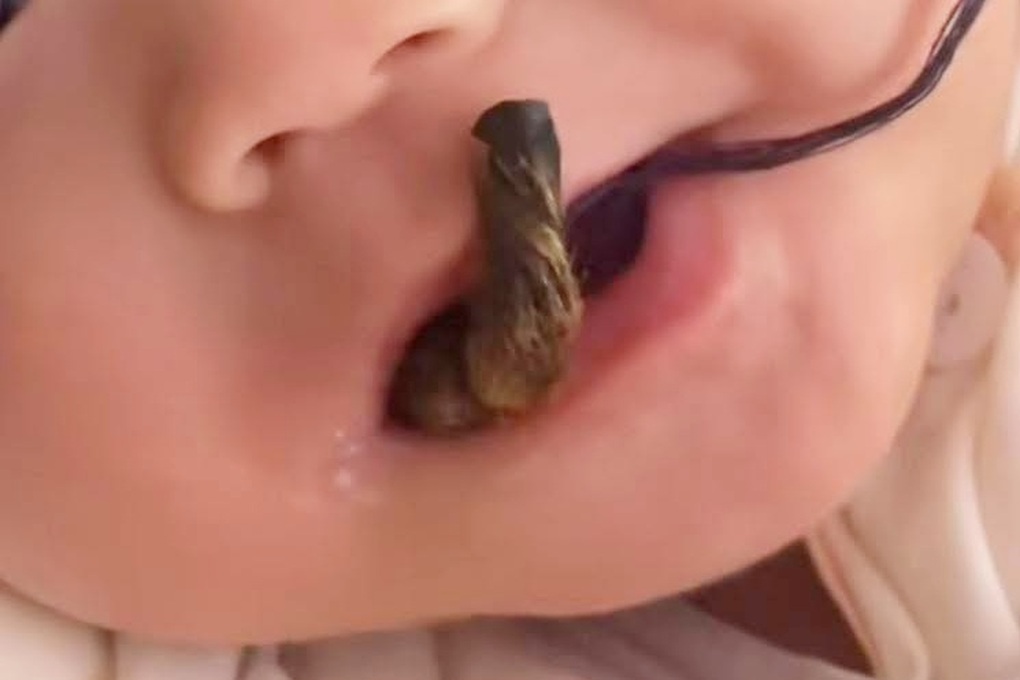 Xôn xao việc cho trẻ ngậm “tay khỉ khô đầy lông” để... ngừa bệnh cam - 1