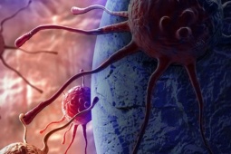 Tế bào ung thư 'thích' gì nhất? Cảnh báo 1 môi trường thuận lợi cho chúng phát triển