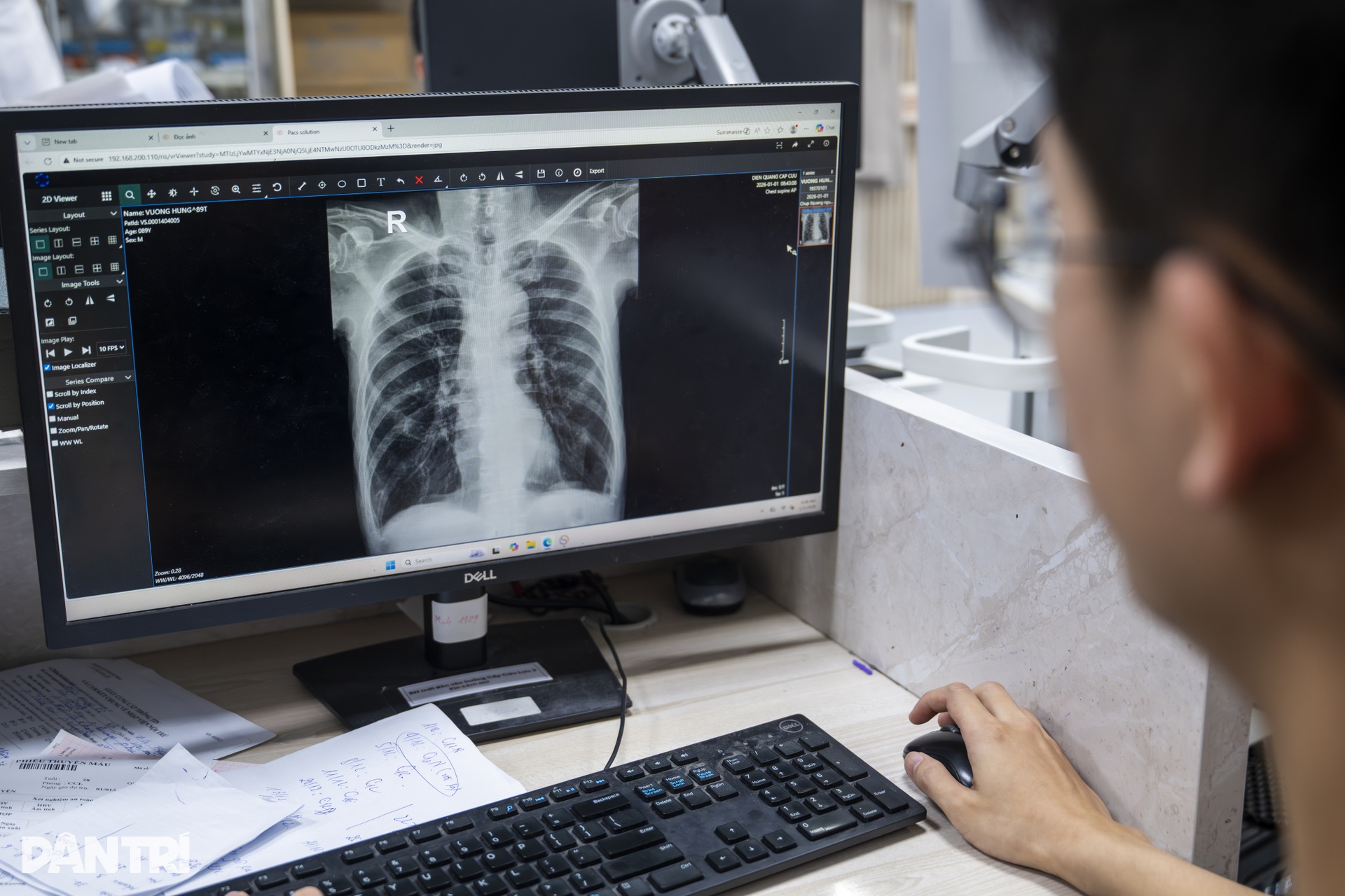 “Cân não” với từng nhịp tim tại nơi giữ trăm sinh mệnh xuyên Tết - 7 “Cân não” với từng nhịp tim tại nơi giữ trăm sinh mệnh xuyên Tết - 7