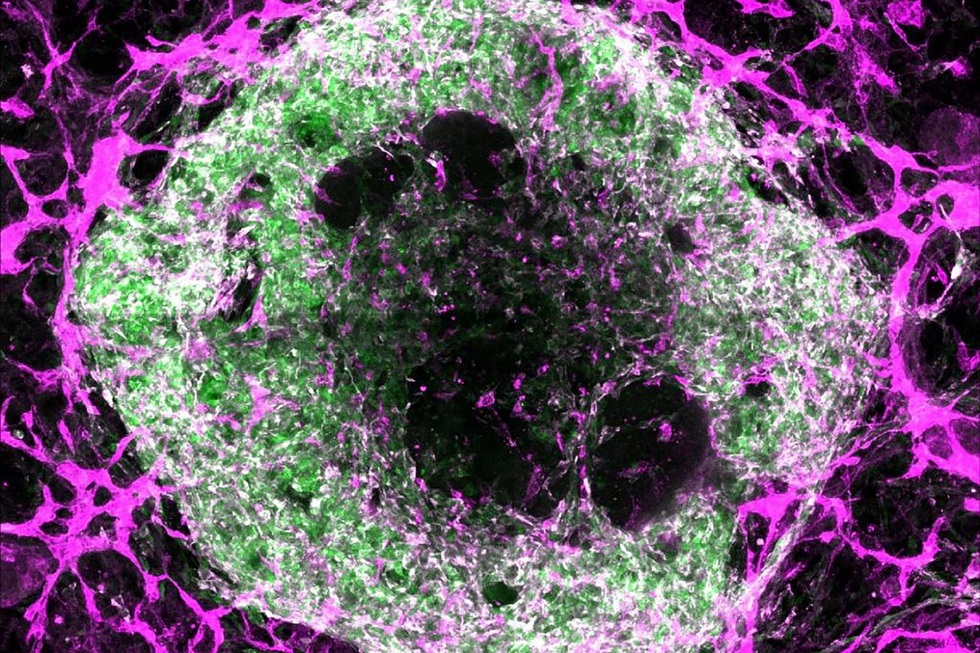 5 đột phá y học năm 2025 thay đổi tương lai nhân loại - 2