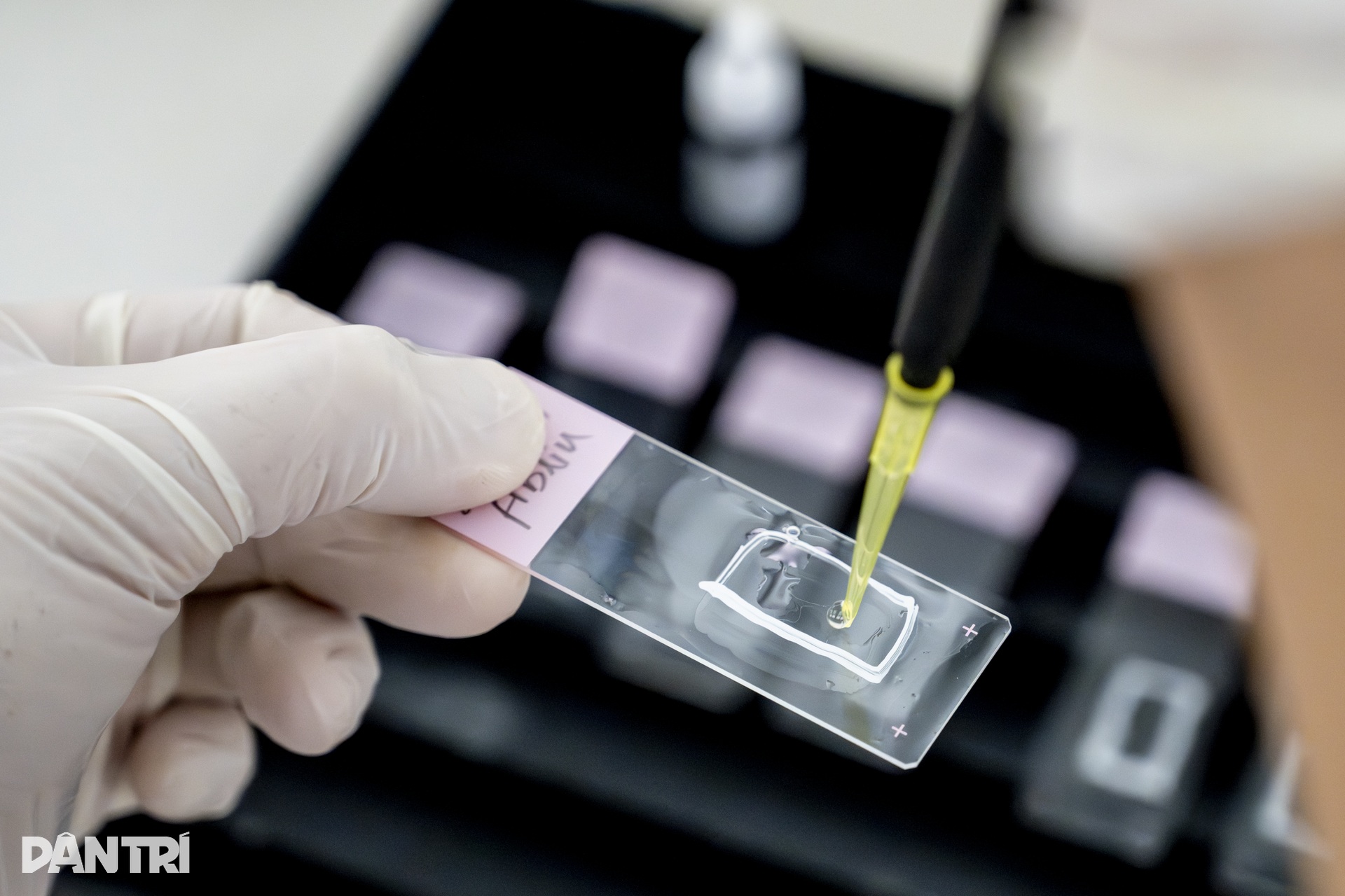 Lát cắt 3 micromet hé lộ “câu chuyện” bên trong cầu thận - 3 Lát cắt 3 micromet hé lộ “câu chuyện” bên trong cầu thận - 3