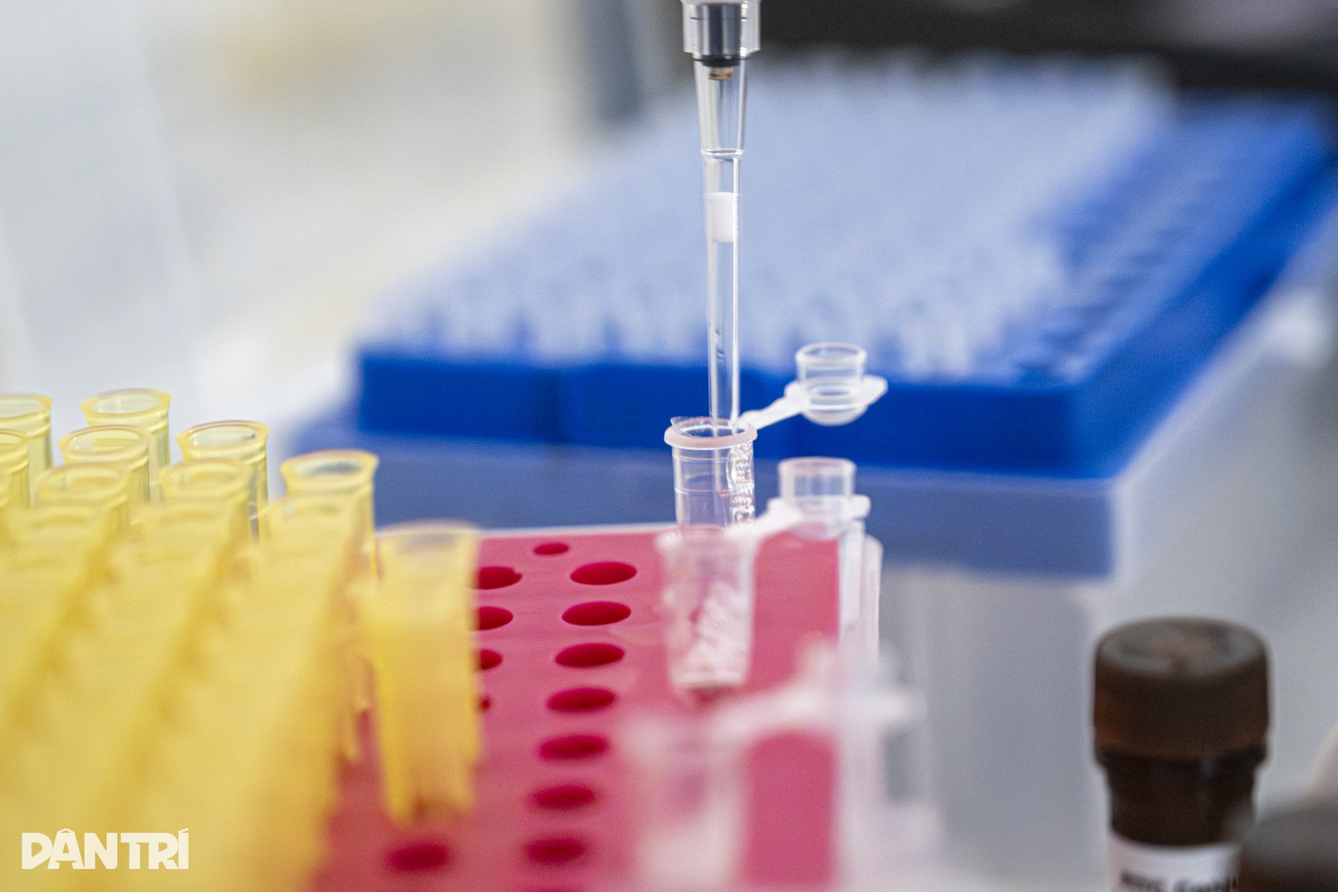 Lát cắt 3 micromet hé lộ “câu chuyện” bên trong cầu thận - 5 Lát cắt 3 micromet hé lộ “câu chuyện” bên trong cầu thận - 5