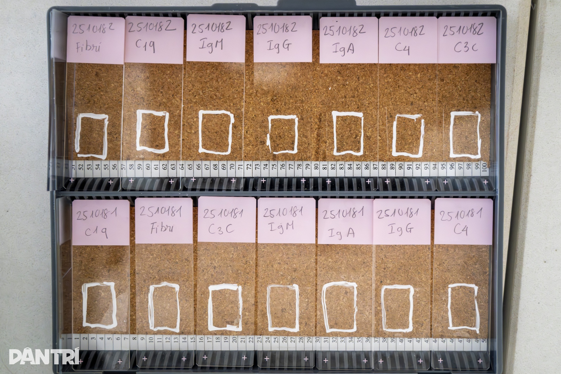 Lát cắt 3 micromet hé lộ “câu chuyện” bên trong cầu thận - 7 Lát cắt 3 micromet hé lộ “câu chuyện” bên trong cầu thận - 7