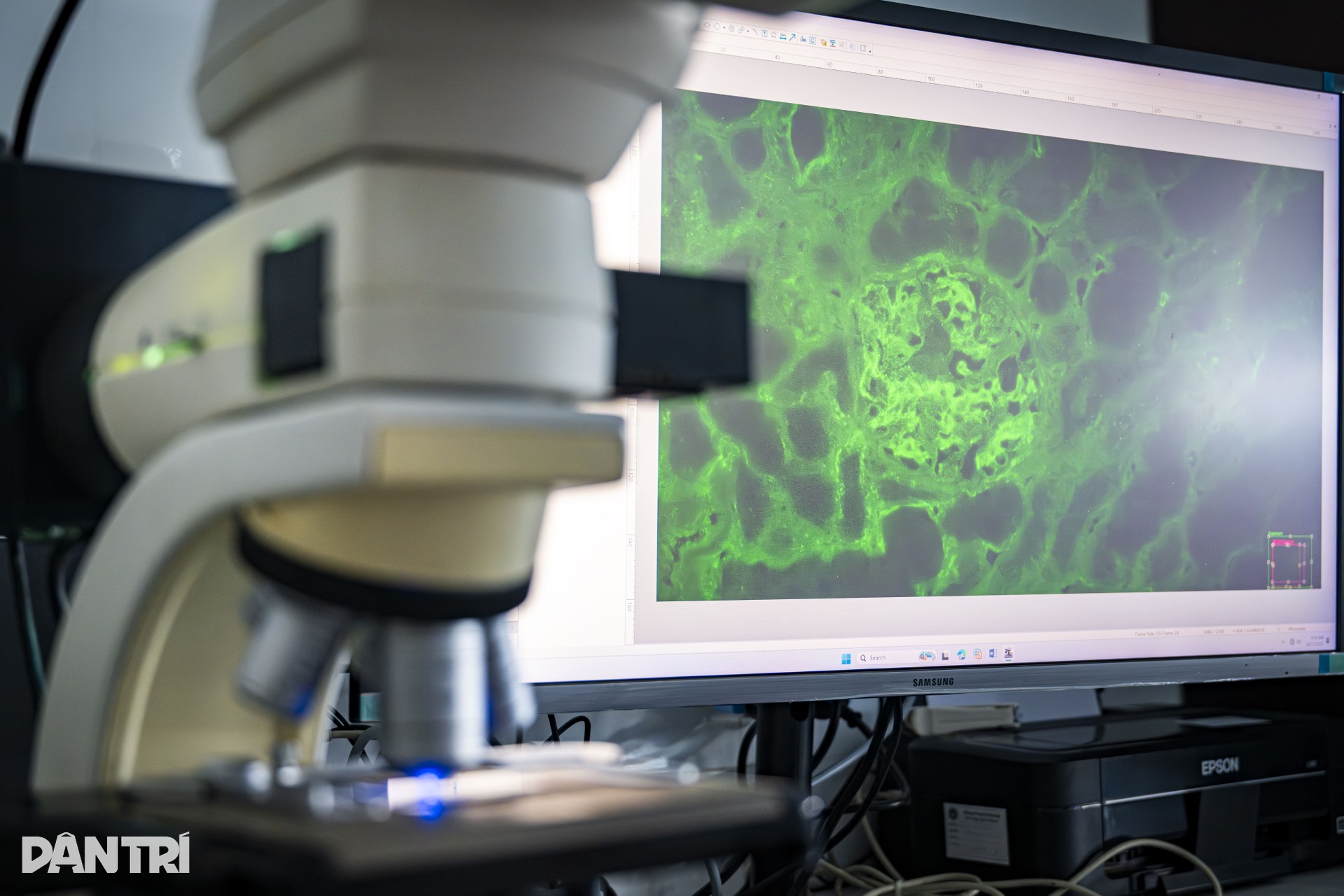 Lát cắt 3 micromet hé lộ “câu chuyện” bên trong cầu thận - 8 Lát cắt 3 micromet hé lộ “câu chuyện” bên trong cầu thận - 8