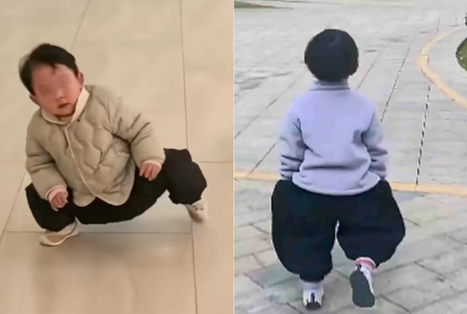 Sau thời gian kiên trì tập luyện, Tiantian đã có thể đứng thẳng và đi lại vững vàng. Ảnh: Douyin