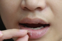 5 dấu hiệu thiếu sắt cần nhận biết sớm, xem ngay để kịp bổ sung