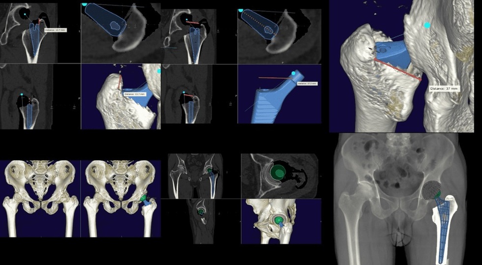 5 kỳ tích viết tên người Việt lên bản đồ y khoa thế giới năm 2025 - 6